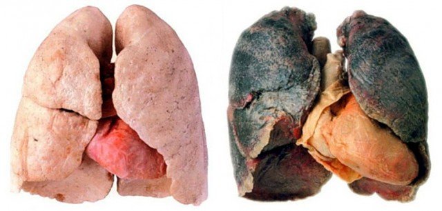 Zdjęcie 5 produktów, które najlepiej oczyszczają płuca z nikotyny i zanieczyszczeń! #2