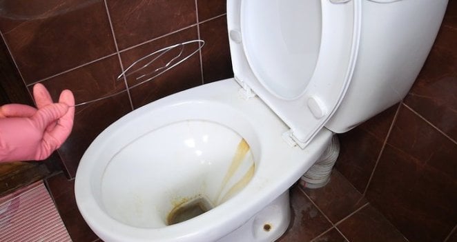 Zdjęcie Jak odetkać toaletę bez przepychacza? 5 świetnych trików! #2