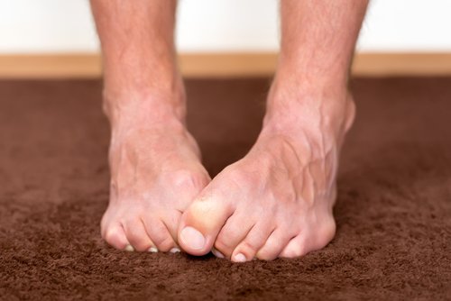 Zdjęcie Obserwuj swoje stopy! Mogą wiele powiedzieć na temat twojego zdrowia #1