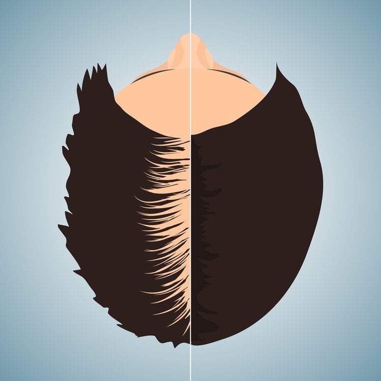 Zdjęcie Skrzyp polny – jak go stosować, aby przyspieszyć porost włosów? #2