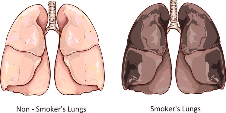 Zdjęcie 4 witaminy, które regenerują płuca palacza #1