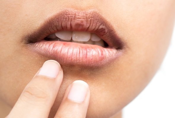 Zdjęcie Jak dbać o usta, aby były pełne, miękkie i gładkie?  5 sprawdzonych trików! #1