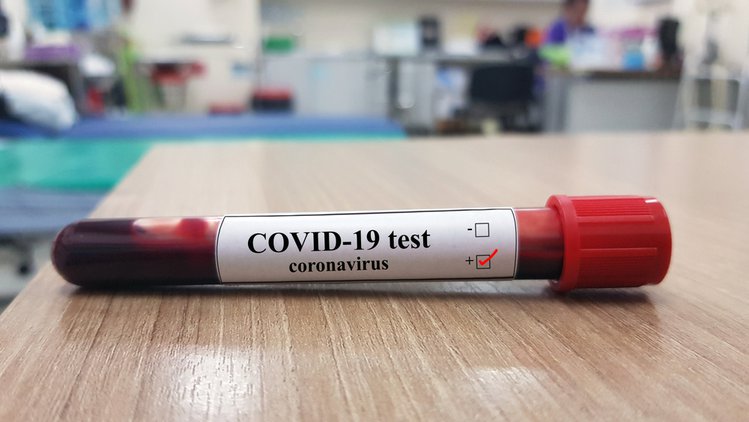 Zdjęcie W Polsce stworzono skuteczny lek na COVID 19! To pierwszy lek na świecie #1
