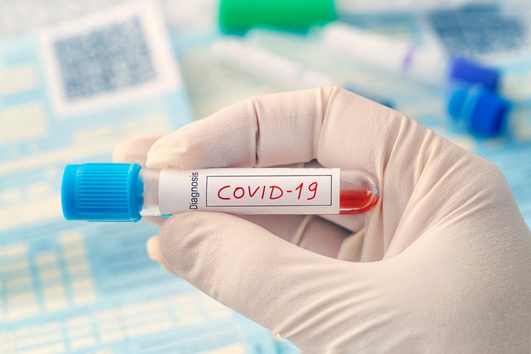 Zdjęcie Pewna firma da naszemu rządowi 100 tys. testów na koronawirusa! Oczekuje w zamian tylko jednego #1