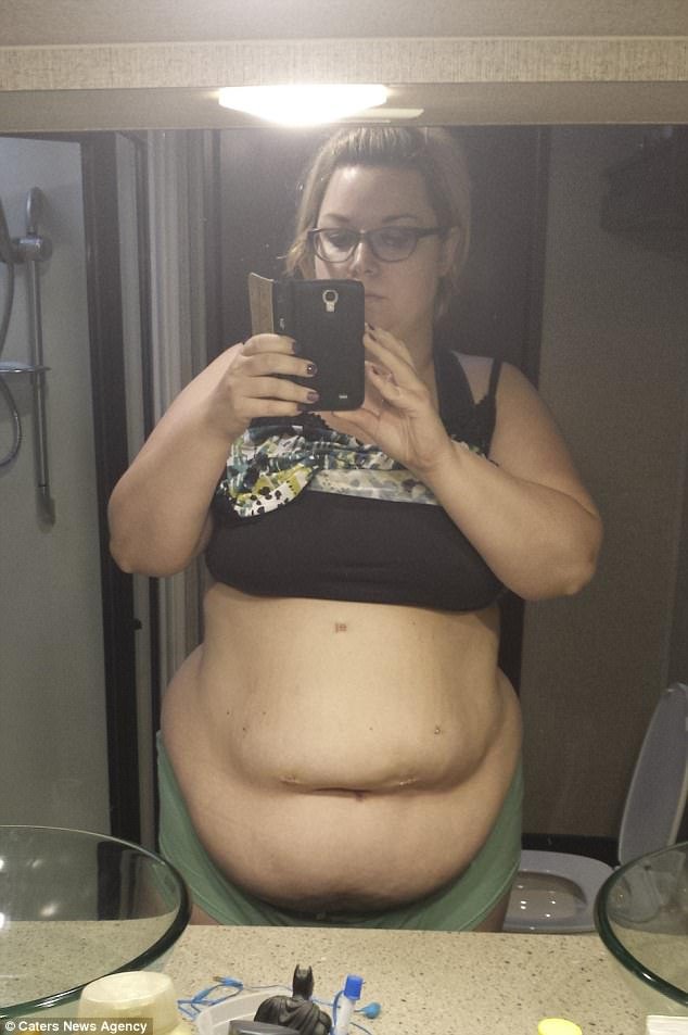 Zdjęcie Zdecydowała się na operację i schudła 60 kg. Teraz twierdzi, że jej ciało wygląda jeszcze gorzej! #2