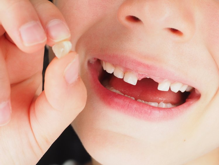 Zdjęcie Przechowywanie mlecznych zębów. Czy warto? To może uratować Ci życie! #2