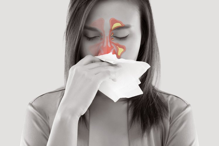 Zdjęcie Jak radzić sobie z alergią? Poznaj 8 skutecznych trików #1