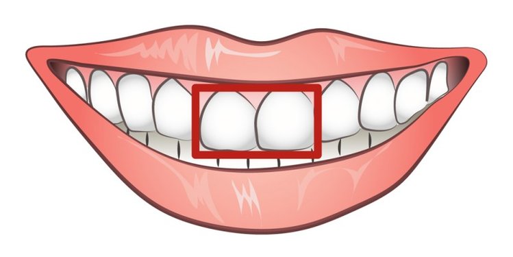 Zdjęcie Czy kształt Twoich zębów określa Twój charakter? #1