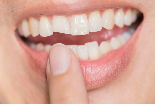 Zdjęcie Ból zębów może zwiastować dalsze problemy zdrowotne. Zobacz, co oznacza ból danego zęba #1