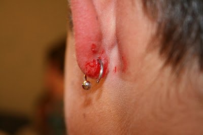 Zdjęcie Przekłuwanie uszu dziecku – dlaczego lepiej poczekać z tym zabiegiem? #1