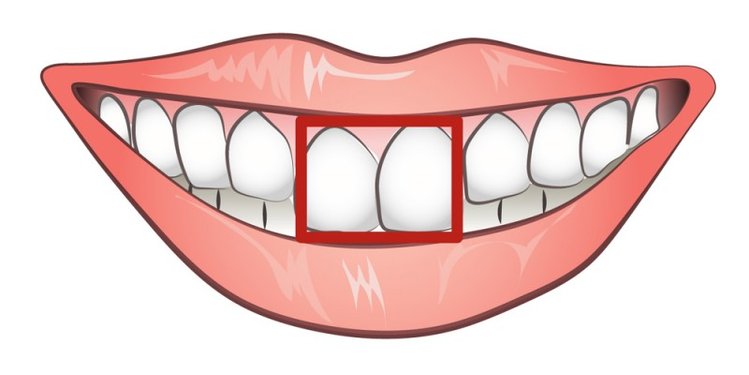 Zdjęcie Czy kształt Twoich zębów określa Twój charakter? #4