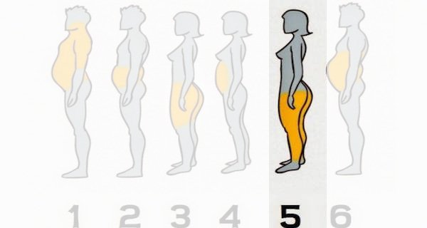 Zdjęcie 6 rożnych typów otyłości - zobacz jak im zaradzić. #5