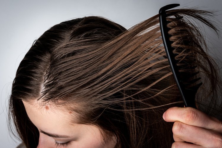 Zdjęcie Jak pielęgnować włosy przetłuszczające się  i z suchymi końcówkami? Oto kilka ważnych zasad! #3