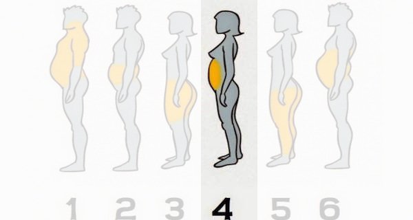 Zdjęcie 6 rożnych typów otyłości - zobacz jak im zaradzić. #4