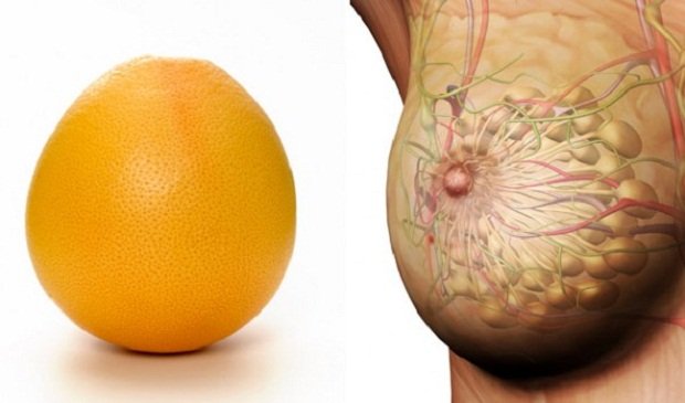 Zdjęcie Owoce i warzywa, które wyglądają tak, jak narządy, które leczą! #6