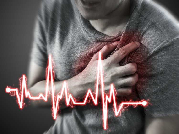 Zdjęcie Jak pomóc osobie z zawałem serca? Te wskazówki pomogą ci uratować komuś życie #1