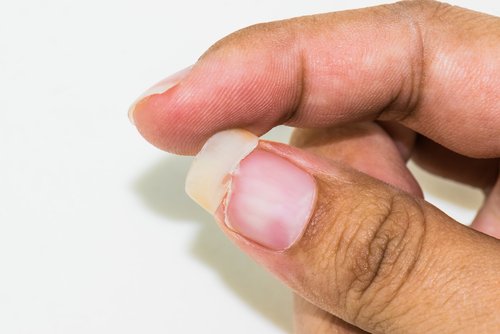 Zdjęcie Jak naprawić złamany paznokieć? Od teraz nie będzie to problemem #1