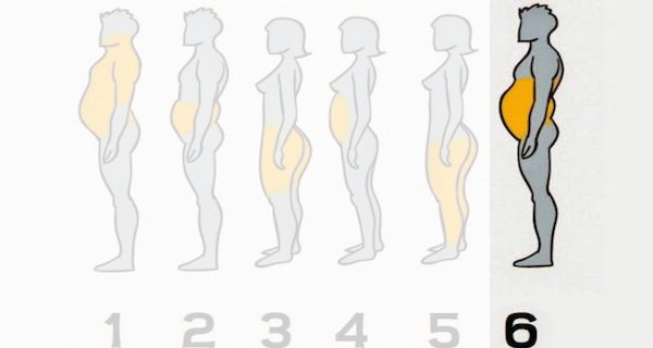 Zdjęcie 6 rożnych typów otyłości - zobacz jak im zaradzić. #6