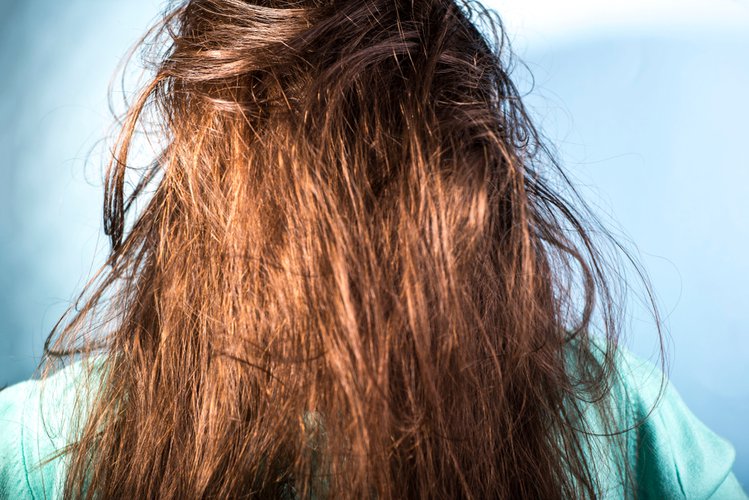 Zdjęcie Jak pielęgnować włosy przetłuszczające się  i z suchymi końcówkami? Oto kilka ważnych zasad! #1