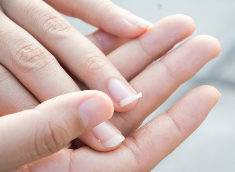 Zdjęcie Obserwuj zdrowie swoich dłoni! Oto 7 rzeczy, które możesz z nich wyczytać #2