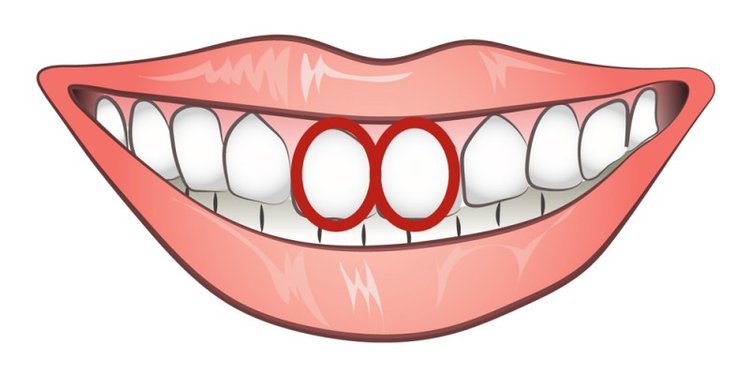 Zdjęcie Czy kształt Twoich zębów określa Twój charakter? #2