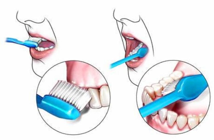 Zdjęcie Wiele osób nieprawidłowo myje zęby! Sprawdź jak poprawnie dbać o higienę jamy ustnej #1