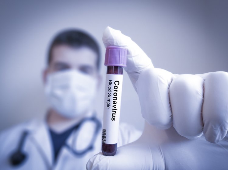 Zdjęcie Ile kosztuje badanie na koronawirusa? Wprowadzono cennik #1