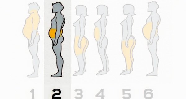 Zdjęcie 6 rożnych typów otyłości - zobacz jak im zaradzić. #2