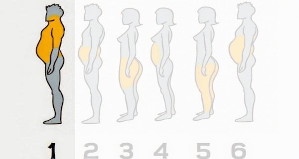Zdjęcie 6 rożnych typów otyłości - zobacz jak im zaradzić. #1