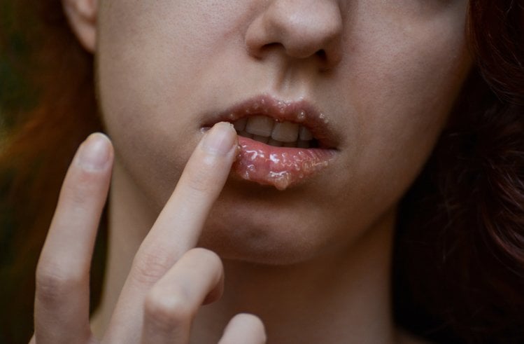 Zdjęcie Jak dbać o usta, aby były pełne, miękkie i gładkie?  5 sprawdzonych trików! #2
