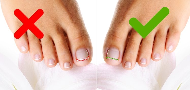 Zdjęcie Jak zadbać o paznokcie u stóp, aby wyglądały idealnie? 5 prostych sposobów #2