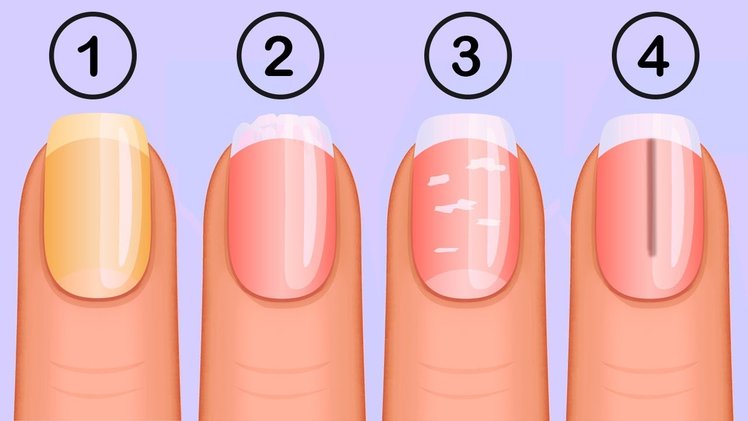 9. Natural Remedies for Improving Nail Color and Health - wide 1