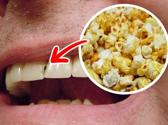 Zdjęcie Zobacz jakie produkty SZKODZĄ Twoim zębom! #4