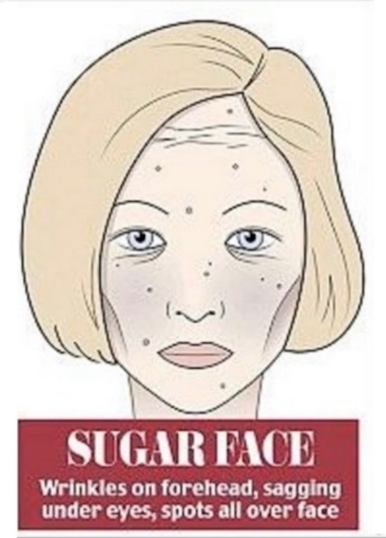 Zdjęcie Jak nadmiar niektórych składników diety odznacza się na Twojej twarzy? #3