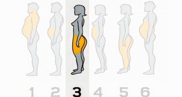 Zdjęcie 6 rożnych typów otyłości - zobacz jak im zaradzić. #3