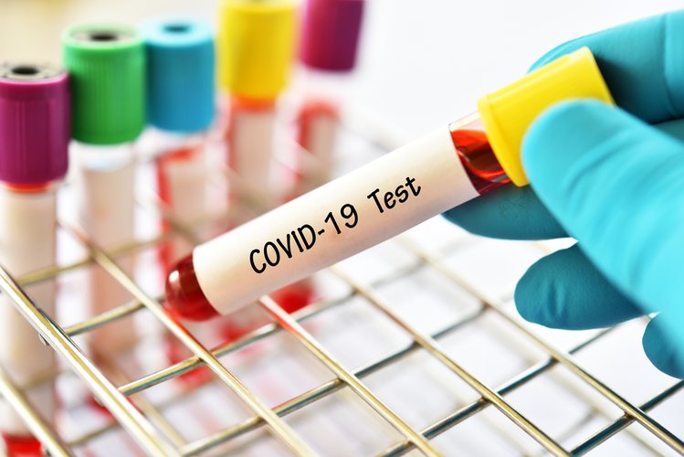 Zdjęcie 9 mitów na temat koronawirusa COVID-19. W co nie powinniśmy wierzyć? #2