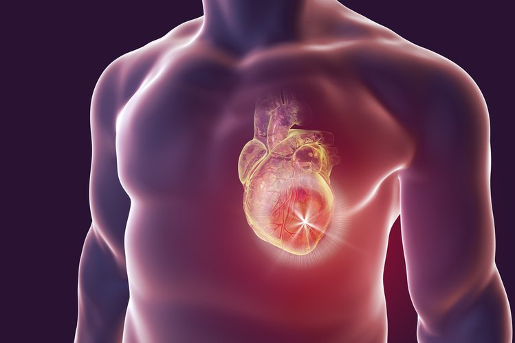 Zdjęcie Jak pomóc osobie z zawałem serca? Te wskazówki pomogą ci uratować komuś życie #2