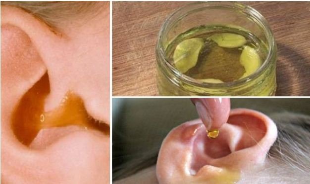 Zdjęcie 3 najskuteczniejsze domowe sposoby na ból ucha #1