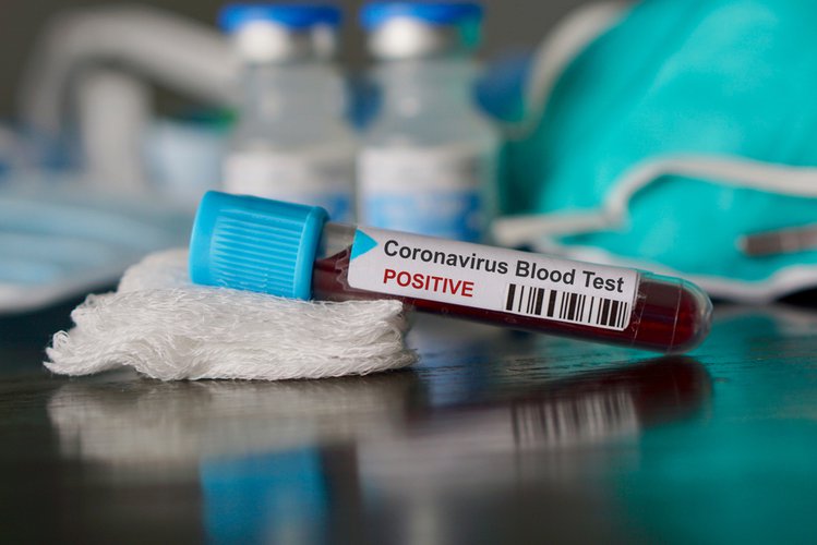 Zdjęcie GIS ostrzega: co trzeci chory na koronawirusa zaraził się w szpitalu lub przychodni #1