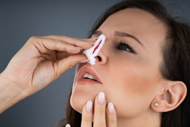 Zdjęcie Krwawienie z nosa - jakie mogą być jego przyczyny? #2
